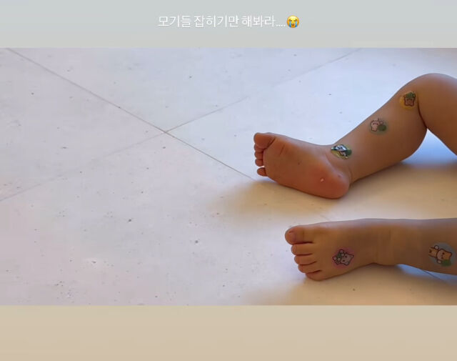 손연재가 모기들에게 분노를 표출했다. / 손연재 인스타그램