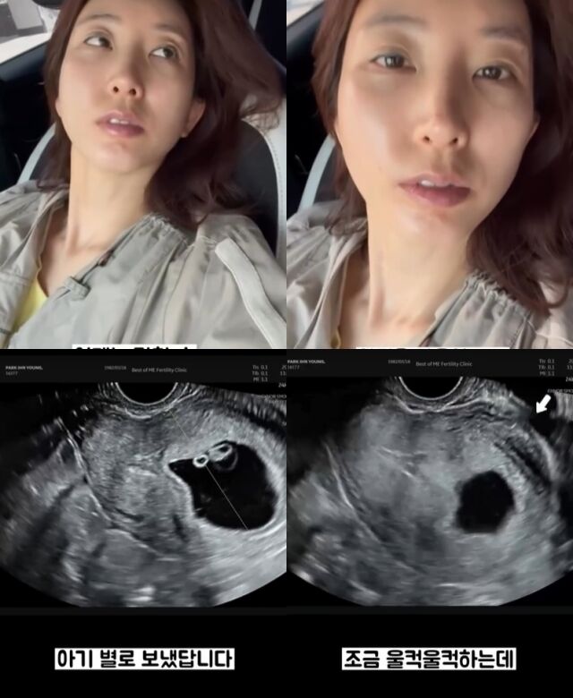 박인영 소셜미디어