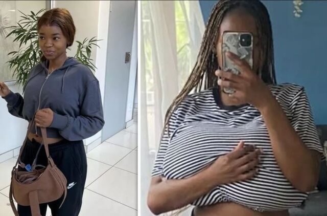 미셜은 갑자기 가슴이 커지는 희귀병을 앓아 큰 고생을 했다./소셜미디어