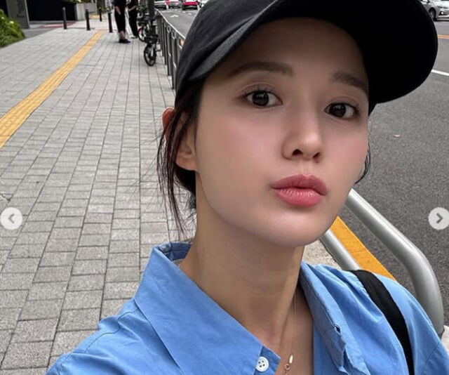 남보라가 친정엄마 무릎 수술에 대한 이야기를 털어놨다. / 남보라 소셜미디어