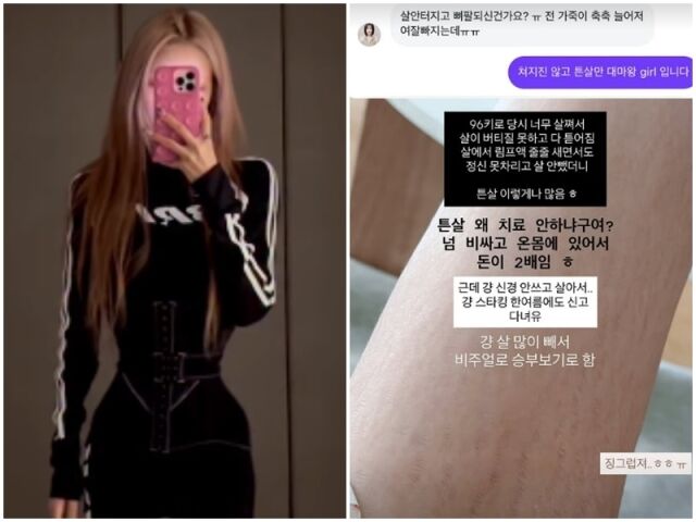 최준희./소셜미디어