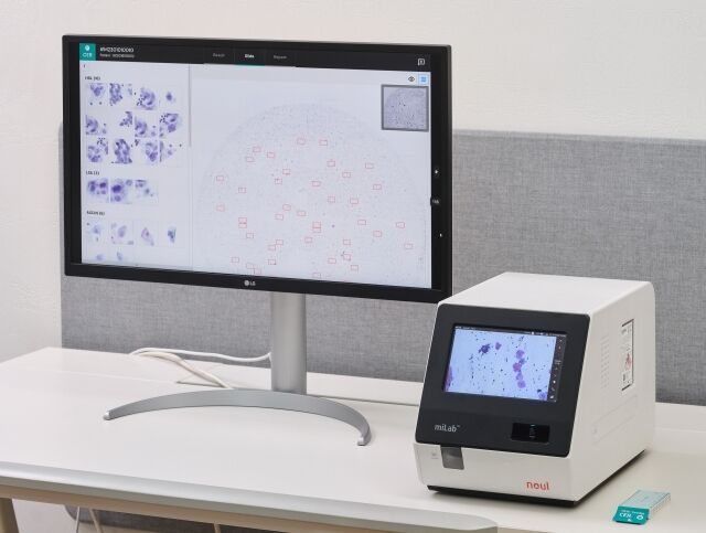 노을 AI 기반 자궁경부암 진단 솔루션(miLab CER). /노을