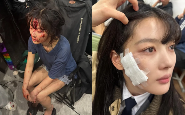 김유정이 '친애하는 X' 속 강렬한 연기 변신으로 시청자들을 사로잡았다. / 김유정 인스타그램