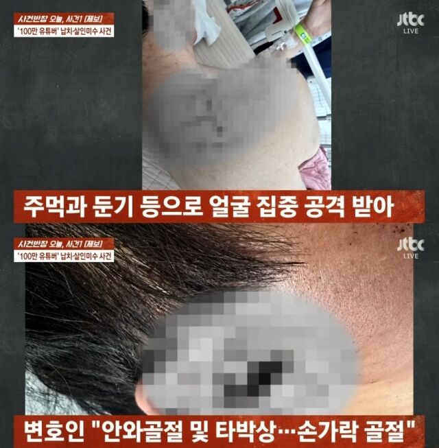 유튜버 수탉, 폭행 이후 모습 / JTBC '사건반장'