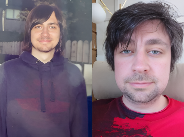 영국의 30대 남성이 14세 때부터 성기와 방광의 감각을 완전히 잃었다고 공개해 화제다./더선