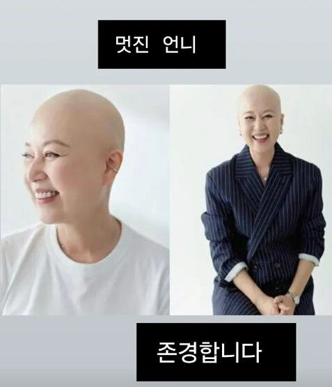 박미선./소셜미디어