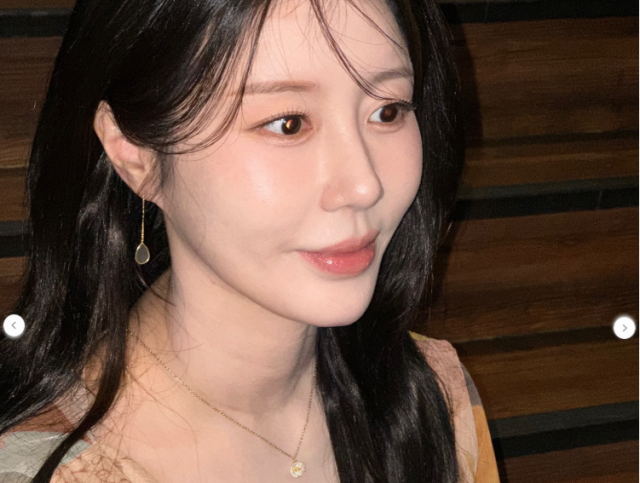 가수 나비./나비 소셜미디어