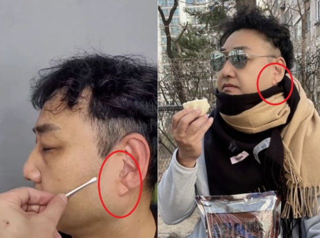 개그맨 김수용이 촬영 중 쓰러져 입원 치료를 받고 있는 가운데, 최근 그의 귓불에서 보였던 ‘사선 주름’이 전조 신호였다는 주장이 온라인에서 퍼지고 있다./김수용 인스타그램