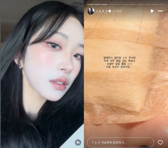 「整形再手術」チェ・ジュンヒ、痛ましい近況「前も見えず涙ばかり垂らす」