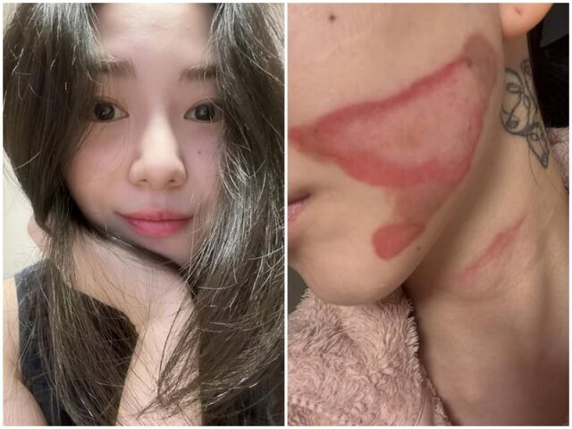 권민아./소셜미디어