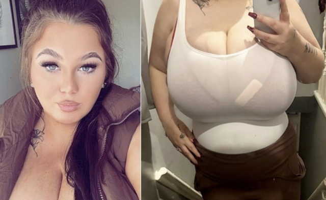 지난 6일(현지시간) 데일리메일 등 외신에 따르면, 노팅엄셔주 렛포드에 거주하는 요양보호사 리리 포터(21)는 ‘NN컵’이라는 비정상적인 가슴 크기로 인해 신체적·정신적 한계에 몰려 있다. /데일리메일 캡처