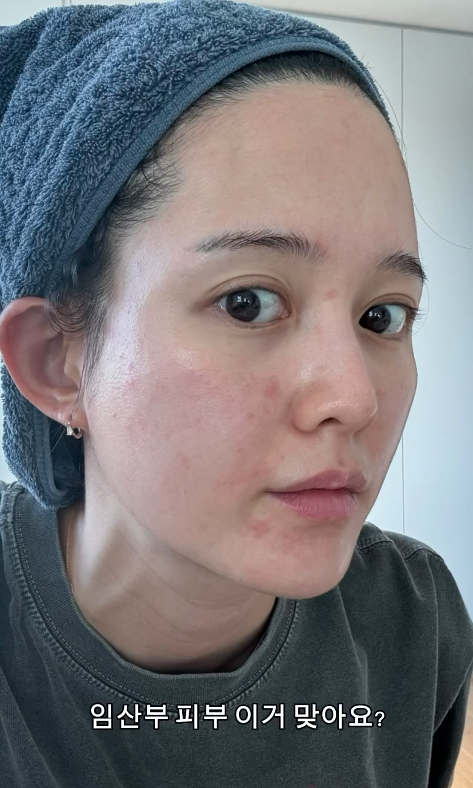 배우 남보라/남보라 인스타그램