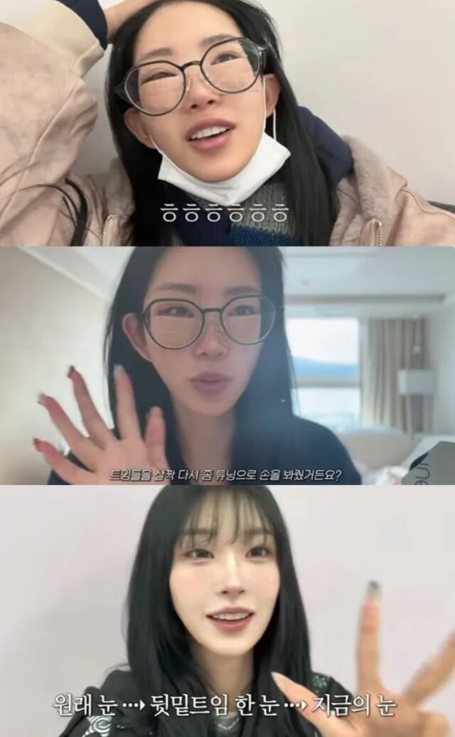 고(故) 배우 최진실의 딸이자 인플루언서로 활동 중인 최준희가 최근 진행한 성형 수술 후기를 상세히 공유하며 화제를 모았다./최준희 유튜브 채널