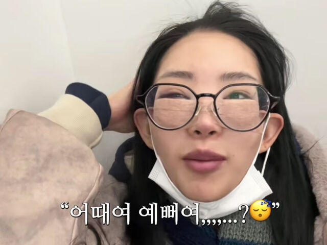 최준희가 눈 성형을 하고 카메라 앞에 섰다. / 유튜브 '준희 JUNEHEE'