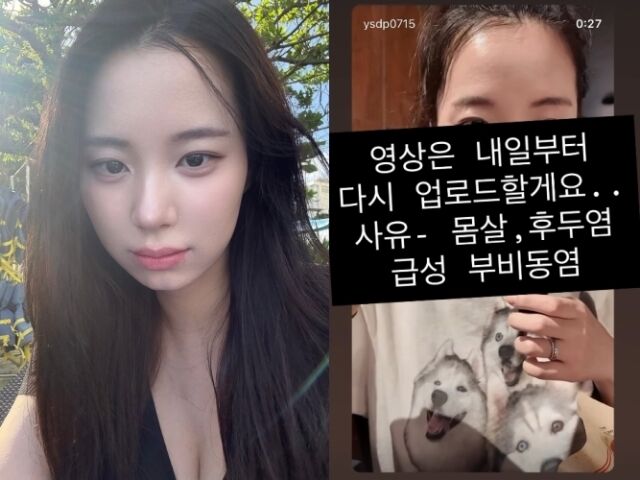 셰프 최현석의 딸인 최연수가 임신 중 컨디션 난조를 겪고 있다고 고백했다. / 최연수 소셜미디어