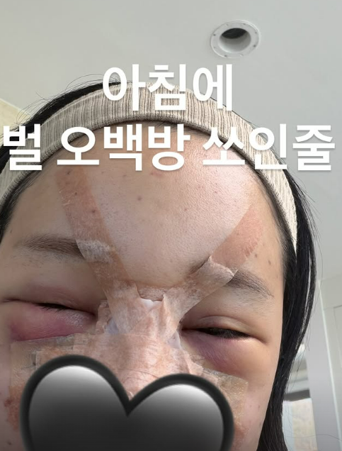 유튜버 랄랄/랄랄 인스타그램