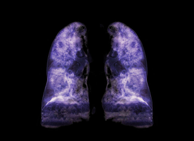 /게티이미지뱅크