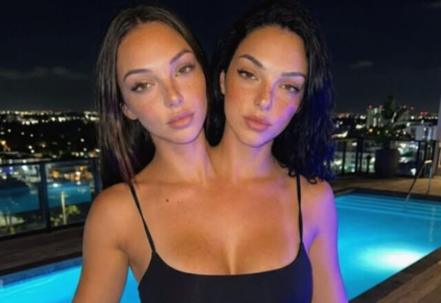 수십만 명의 팔로워를 모은 샴쌍둥이가 AI 캐릭터로 밝혀져 논란이 일고 있다./소셜미디어