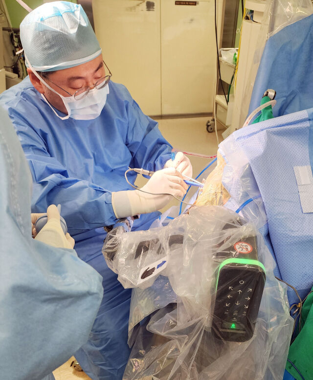 세브란스병원 신경외과 장원석 교수가 뇌로봇수술을 진행 중이다. /세브란스병원