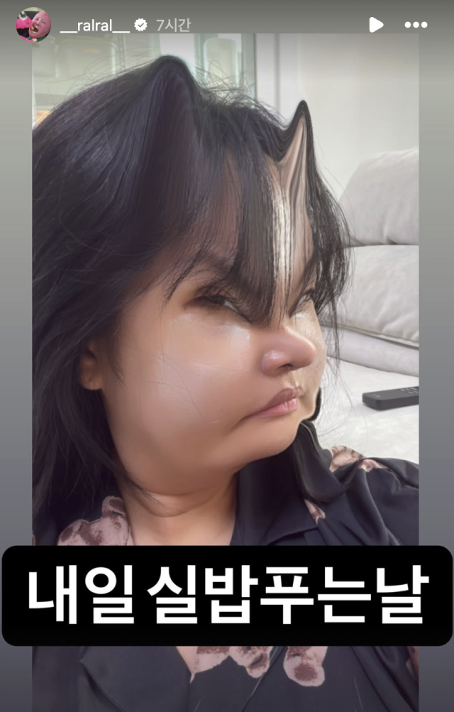 랄랄이 성형 수술 이후 달라진 근황을 공개했다. / 랄랄 SNS