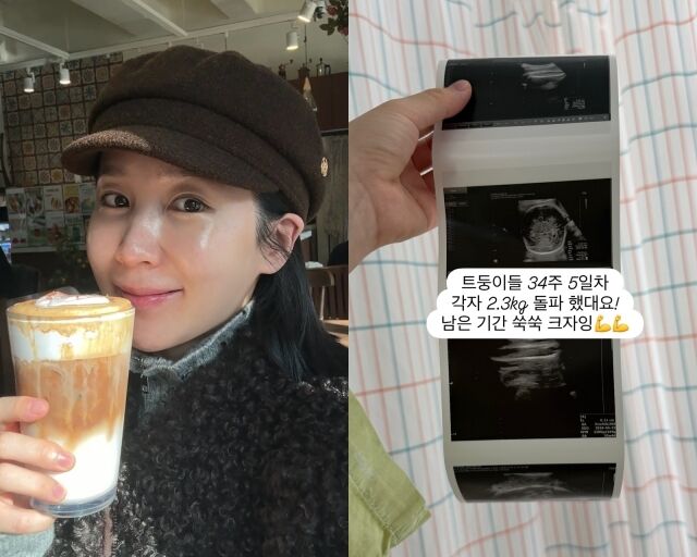 그룹 크레용팝 출신 초아, 초아가 게재한 사진/초아 소셜미디어