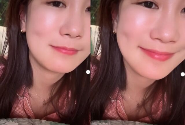 개그우먼 김지민이 욕실 낙상사고 후 치료 과정을 알리며 팬들의 우려를 자아냈다./김지민 소셜미디어