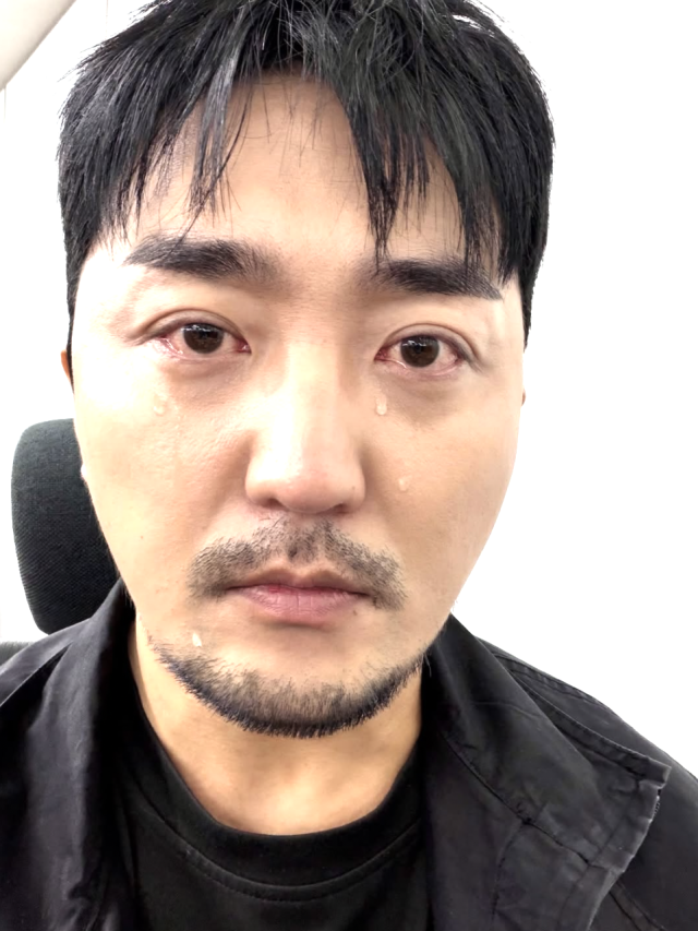 유병재가 눈물 셀카를 공개했다. / 유병재 SNS