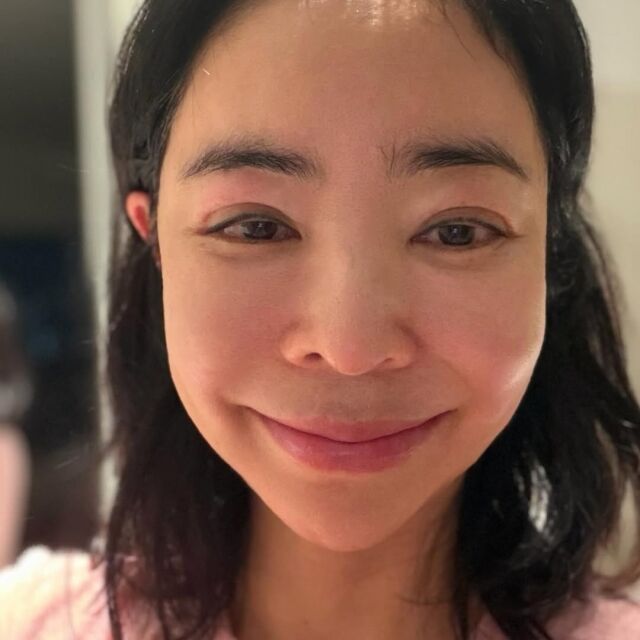 이혜영이 림프 부종으로 고생 후 회복 중인 근황을 전했다. / 이혜영 SNS