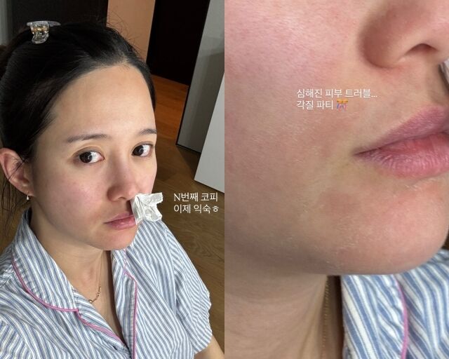 배우 남보라, 남보라가 게재한 사진/남보라 소셜미디어