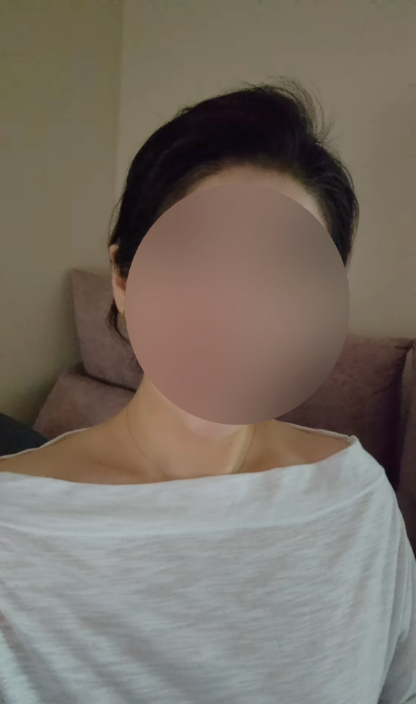 주사 이모 A씨가 자신의 모습을 공개했다. / 주사이모 SNS