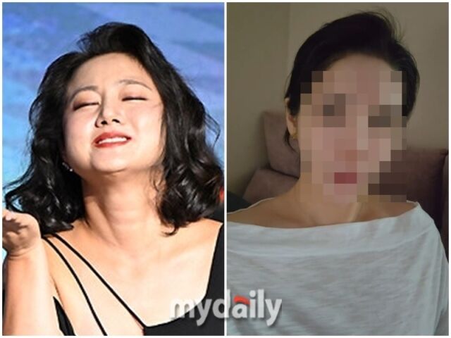 박나래, 주사이모./마이데일리DB