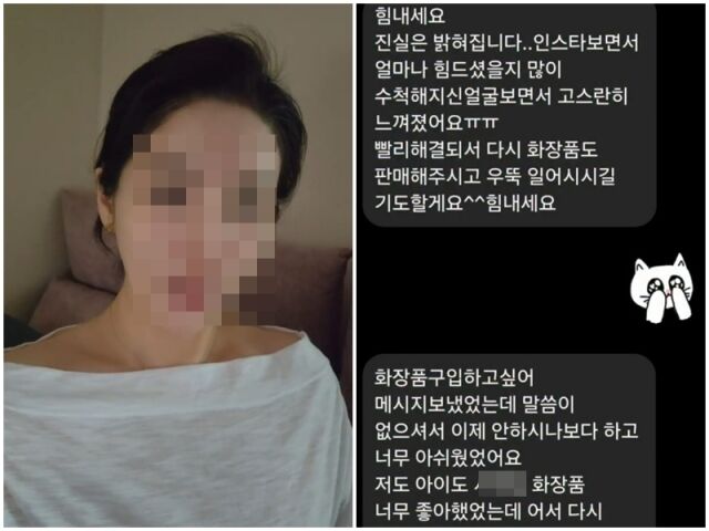 박나래 주사이모./소셜미디어
