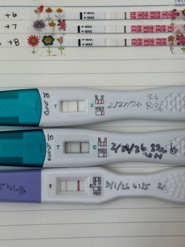 서동주가 두 줄이 뜬 임신 테스트기를 공개했다. / 서동주 소셜미디어