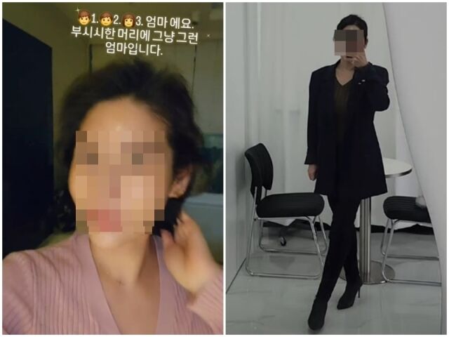 주사이모 A씨./소셜미디어