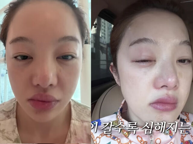 황보라가 시험관 주사를 맞고 부작용을 호소했다. / 유튜브 '황보라 보라이어티'