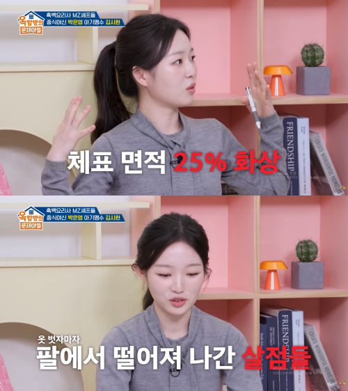 셰프 김시현이 화상을 입은 사연을 털어놨다. / KBS 2TV '옥문아'