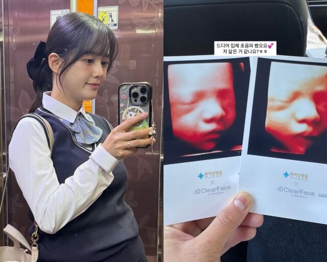 배우 남보라, 남보라가 게재한 사진/남보라 소셜미디어