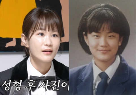 김지민, '못생겼다' 악플 세례&hellip;알고 보니 성형 후 사진이었다