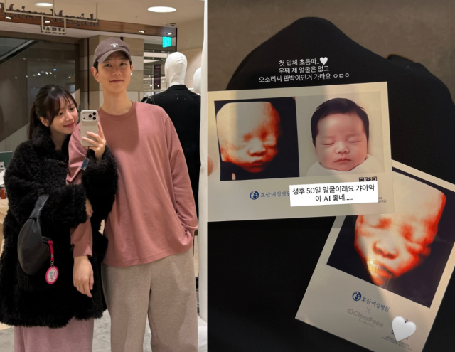 김지영이 첫 입체 초음파 사진을 공개했다. / 김지영 SNS