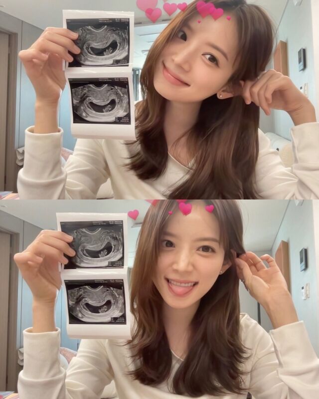 채널A '하트시그널4' 출연자 겸 인플루언서 김지영/김지영 소셜미디어