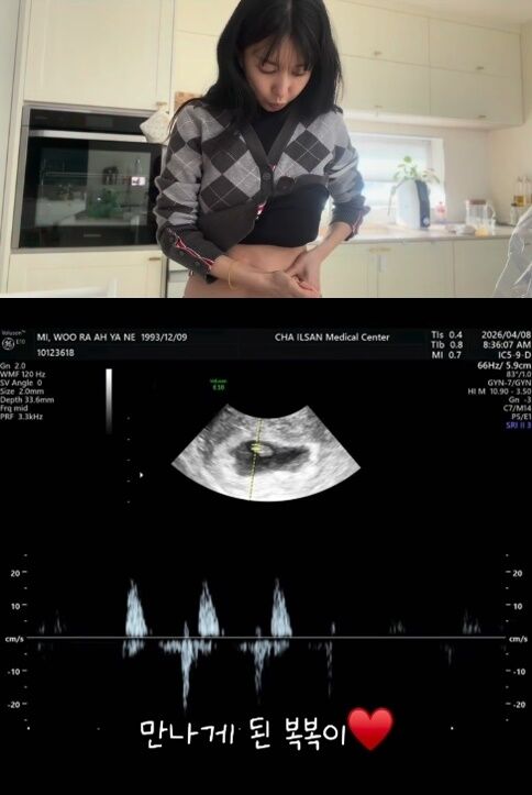 뮤지컬 배우 이지훈의 아내 아야네가 난임을 극복하고 두 아이의 부모가 된다는 소식을 전해 화제다./아야네 소셜미디어