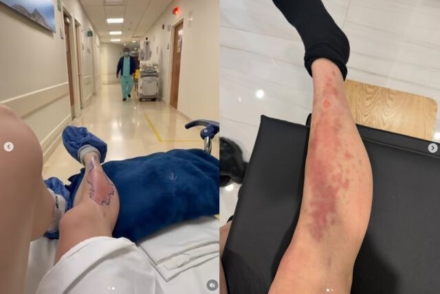 미국 록밴드 '더 프리티 레크리스'의 보컬 테일러 맘슨(32)이 월드 투어 중 독거미에 물려 병원 신세를 지게 됐다. /테일러 맘슨 소셜미디어