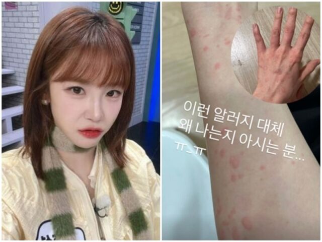 전효성./소셜미디어