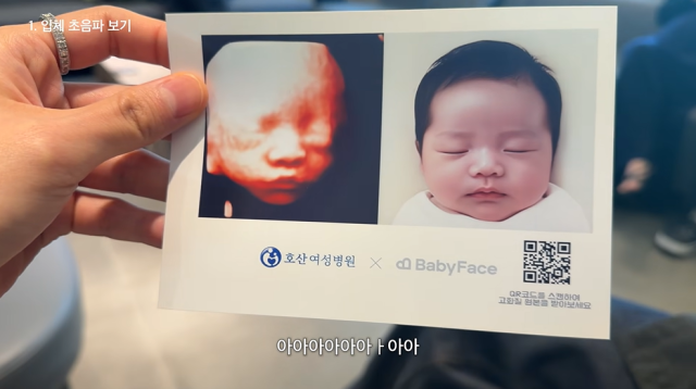 김지영 입체 초음파/유튜브 채널 '김지영'