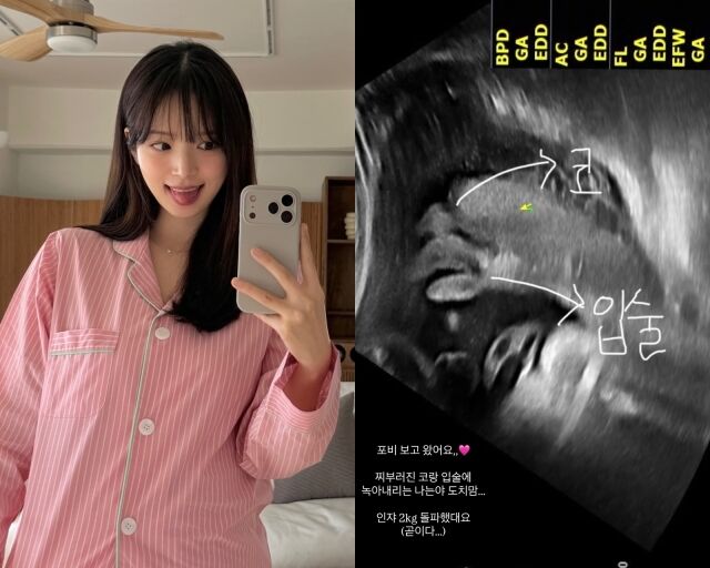 '하트시그널4' 출신 인플루언서 김지영, 김지영이 게재한 사진/김지영 소셜미디어