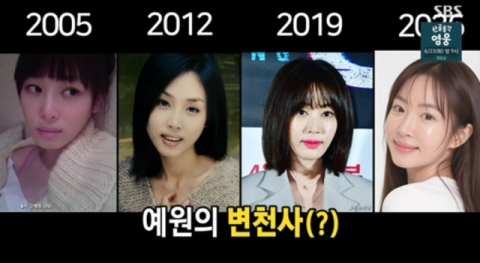 "몰래 성형 좀 그만해"&hellip;강예원, '7번 성형' 인정에 어머니 '멘붕' [미우새]