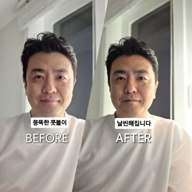 최동석이 코 관리용 미용 기기 사용 후기를 공개해 화제를 모았다. / 최동석 SNS