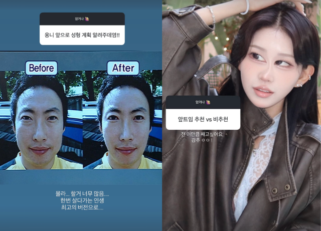최준희가 추가 성형에 대한 생각을 솔직하게 밝혔다. / 최준희 SNS
