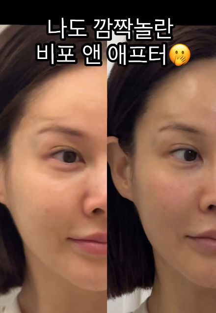 아이비 SNS