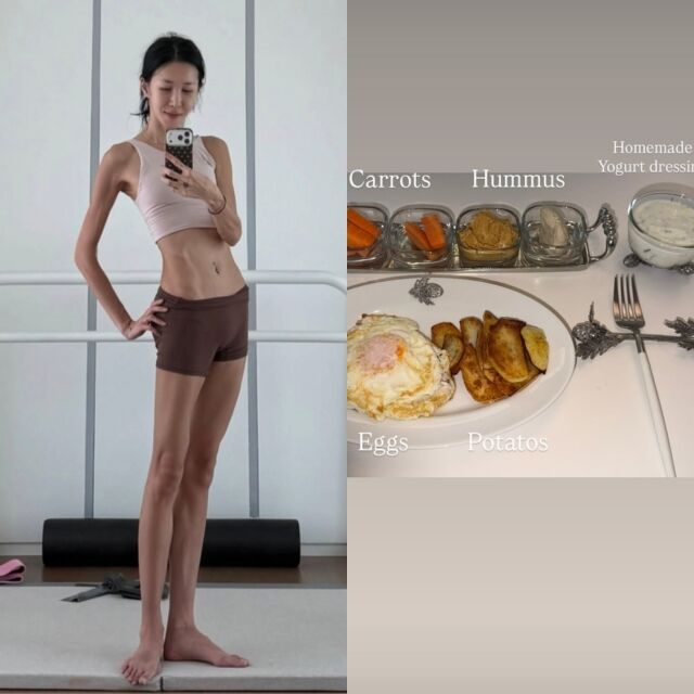 발레무용가 겸 방송인 윤혜진, 윤혜진이 게재한 사진./윤혜진 소셜미디어